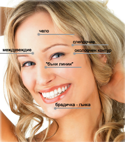 botox