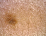 diagnostika koja