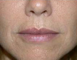 filler2